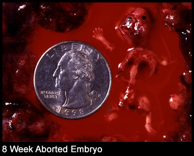 8 weeks aborted