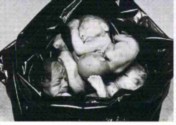 abortion picture 1