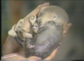 abortion picture 3
