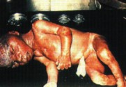 abortion picture 10