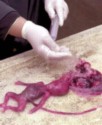 abortion picture 18
