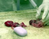 abortion picture 19