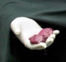 abortion picture 21