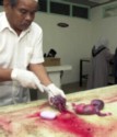 abortion picture 22