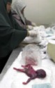 abortion picture 23